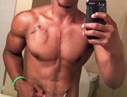 Il culturista col cuore artificiale…